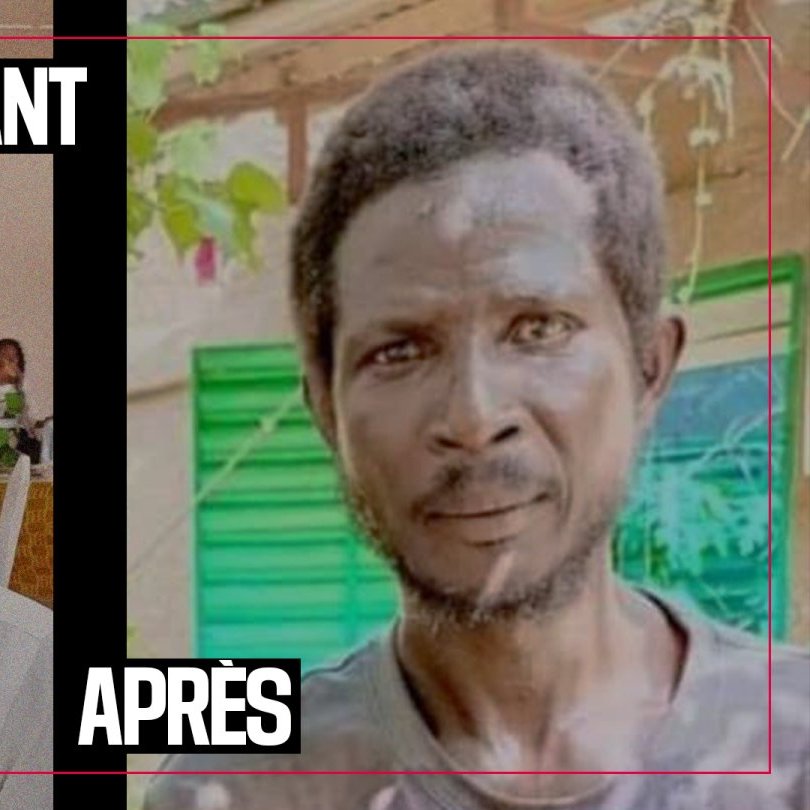 L'image est divisée en deux parties : à gauche, on voit un homme bien habillé, souriant, avec des lunettes et une chemise à motifs verts. Il a l'air soigné et détendu, entouré d'un environnement de fête ou de réunion. À droite, l'homme apparaît dans une situation contrastante. Son visage est plus marqué, il a une barbe peu soignée et des cheveux ébouriffés. Son regard semble plus fatigué et il porte des vêtements usés. L'arrière-plan montre une fenêtre verdâtre, suggérant un cadre moins festif et peut-être plus modeste. Cette comparaison met en évidence un changement significatif dans l'apparence de l'homme, symbolisant peut-être des difficultés ou des transformations dans sa vie.