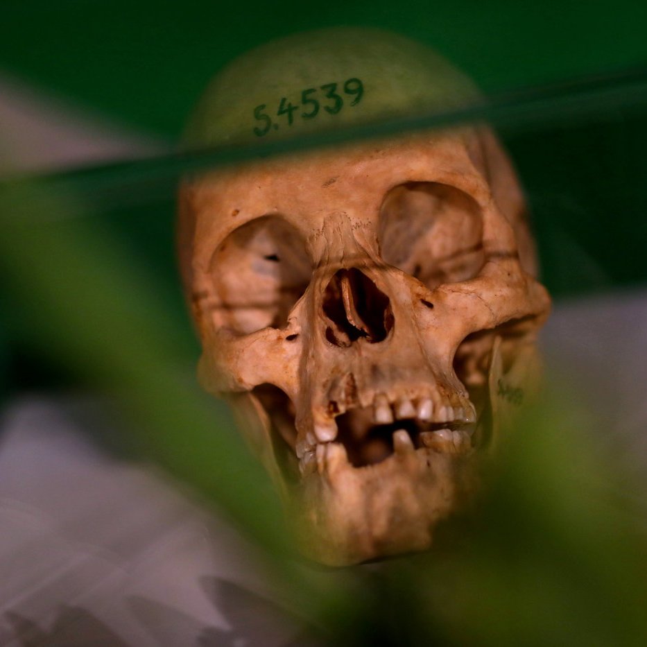 L'image montre un crâne humain placé sous une vitrine. Le crâne est beige, avec des détails visibles des dents et des cavités. Un numéro, "S.4539", est inscrit sur le sommet du crâne. En arrière-plan, on aperçoit des formes floues qui semblent être de la végétation, ajoutant une touche de verdure à la scène. La lumière se reflète légèrement sur le verre de la vitrine, créant un effet de transparence. L'ensemble dégage une ambiance à la fois scientifique et légèrement mystérieuse.