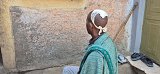 Alemu Haile, 37, was shot and injured during the demonstration in Adi Gudum on 11 March.